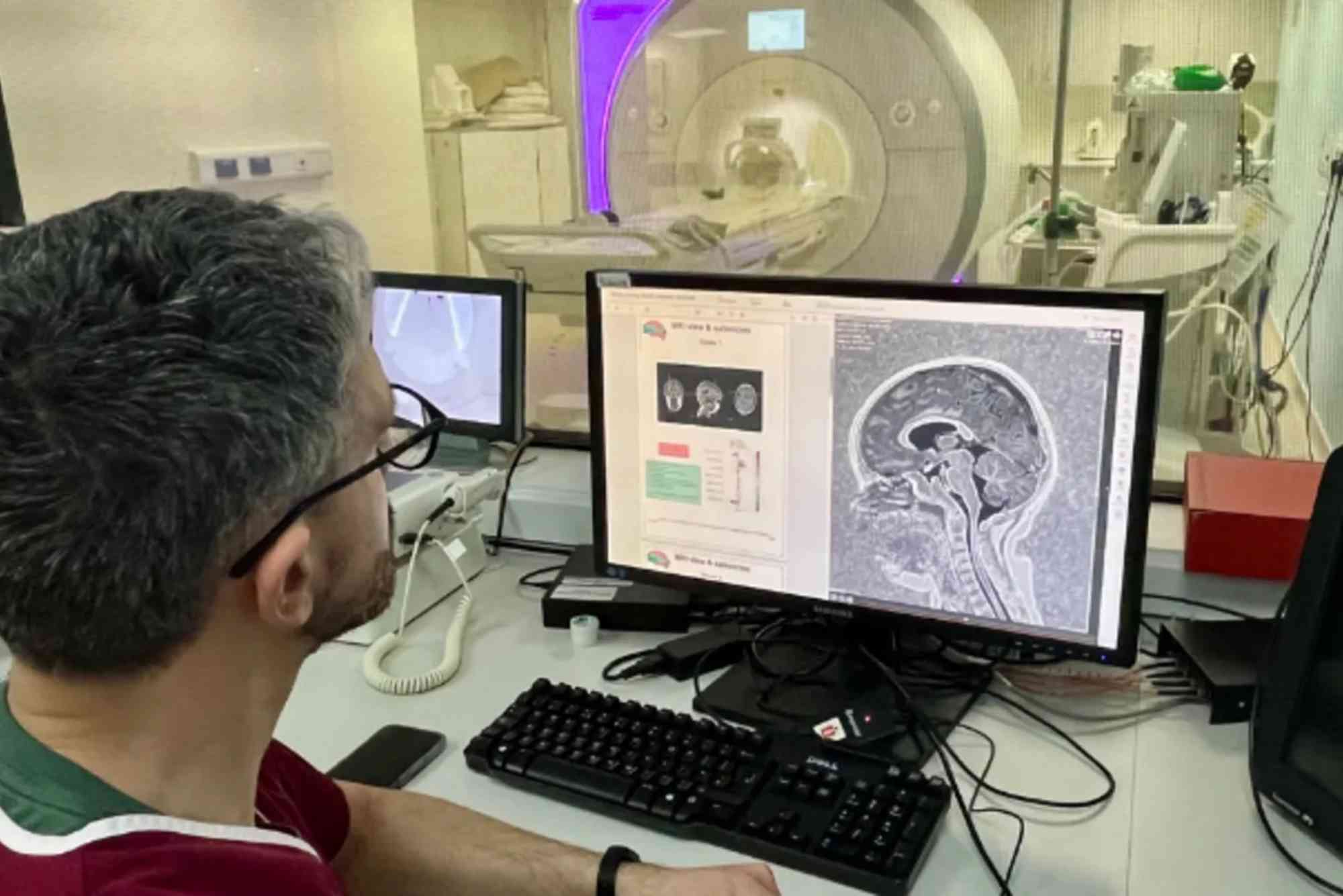 New AI Tool Helps Radiologists Detect Early-Stage Disease Faster